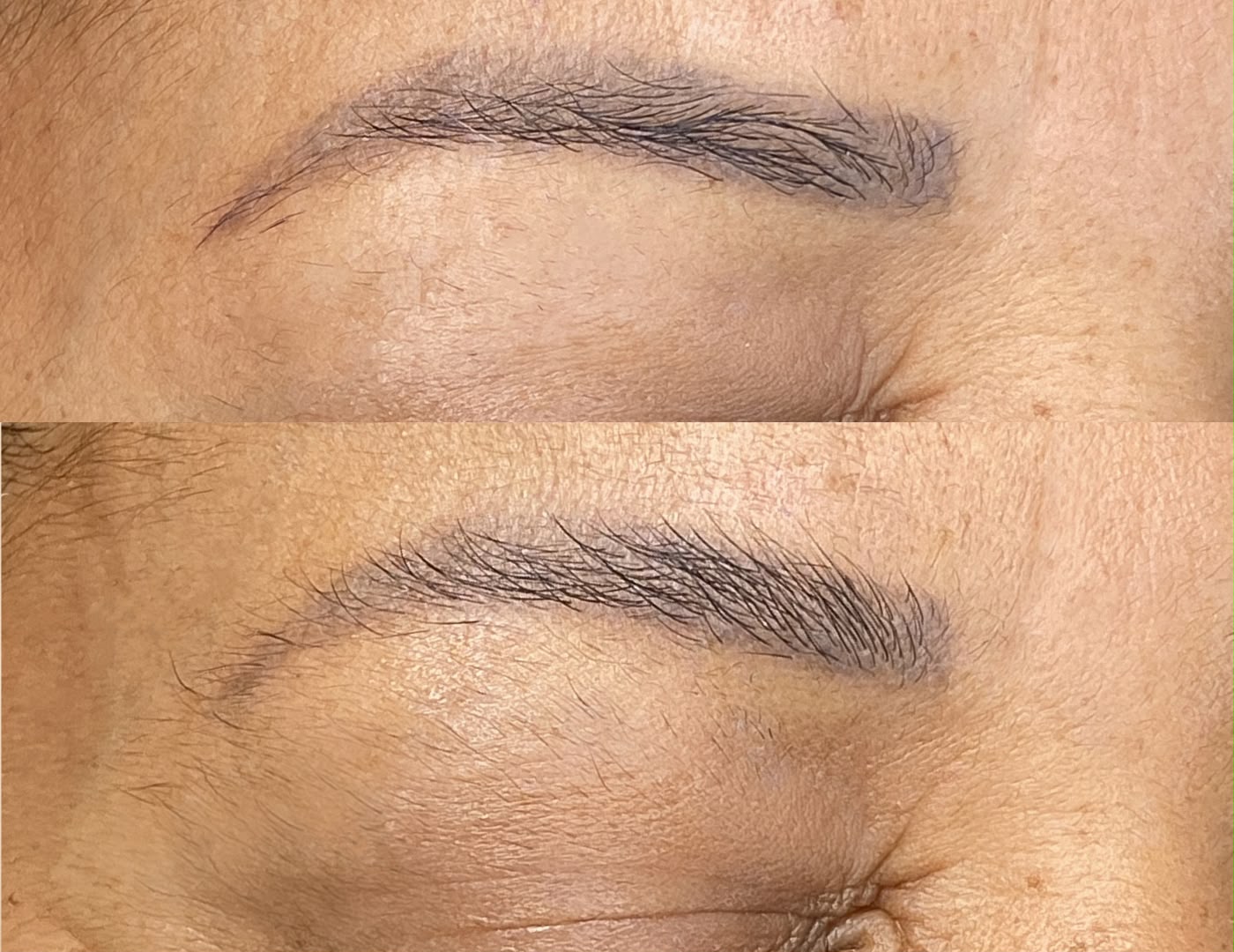 Antes e Depois Exobrows 2